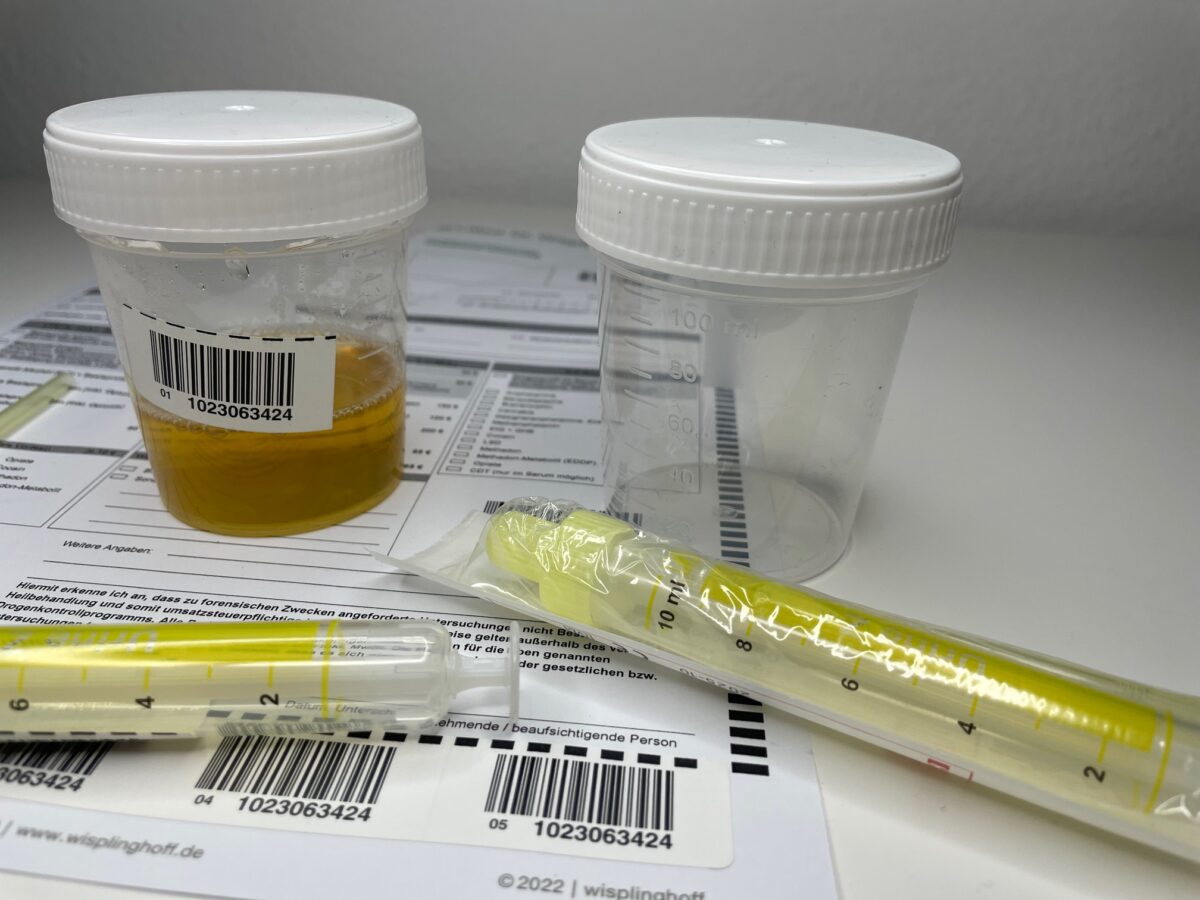 Wegen gefälschter Haaranalyse verurteilt